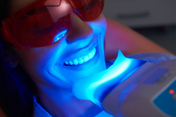 teeth whitening treatment at baghel's dentalworld