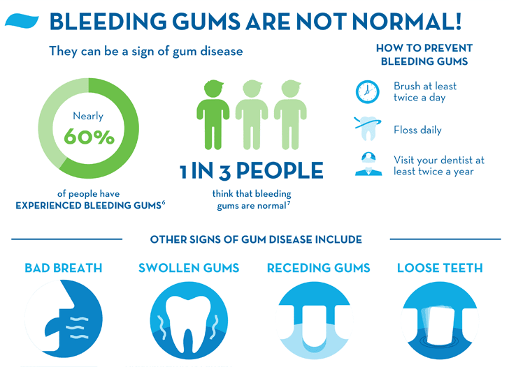 chart on causes of bleeding gums by dentist in india