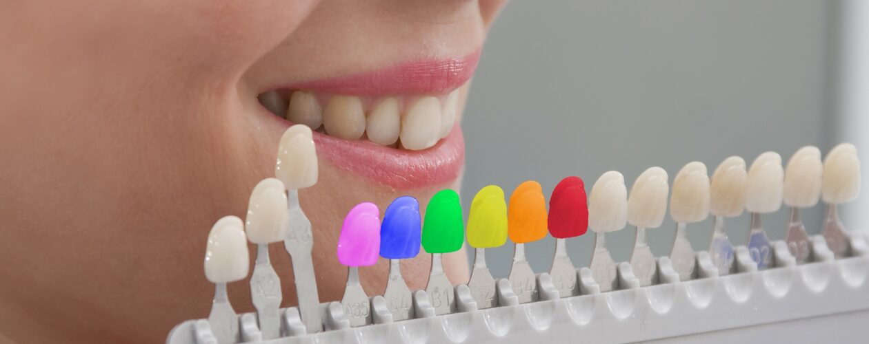 colored dental fillings goregaon east