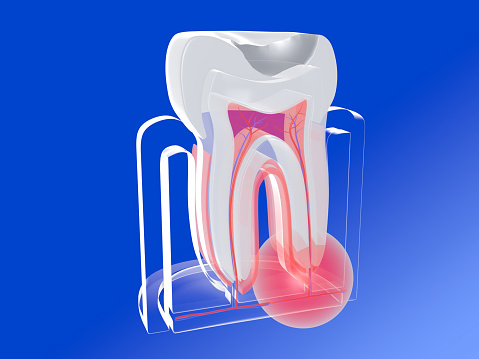 root canal treatment in mumbai