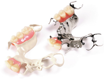 removable denture made in PEEK and metal 