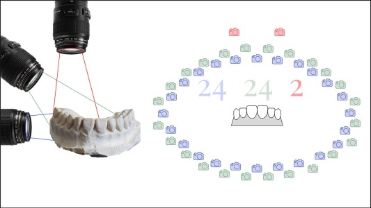 digital dental scan