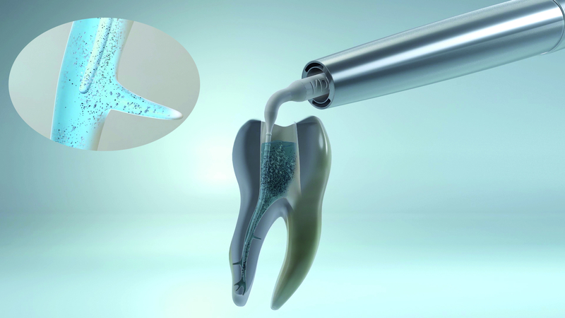root canal irrigants vdw endo system